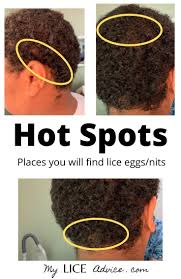 You might have come across little black bugs in your house furniture, walls, carpet, and many other places. If You Ve Found Black Bugs In Your Child S Hair Or You Are Having Difficulty Finding Lice In Black Hair You Are Not Alone Hair Lice Black Hair Dandruff Remedy
