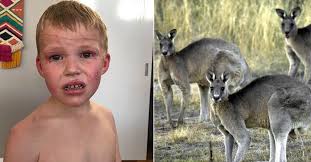 NSW news: Kangaroo mauls five-year-old boy in northern NSW as drought  continues