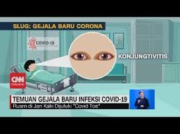 Virus ini menjadi varia baru yang perlu diwaspadai karena lebih menular. Temuan Gejala Baru Infeksi Covid 19 Youtube