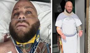 Brit tourist tells of Tenerife holiday from hell after being ploughed into  by minibus