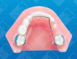 Lingual Arch U L Dental Appliance Of Choice Unilateral Arch Length Aparatos De Ortodoncia Ortodoncia Odontologia