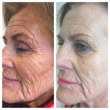 Dermaceutic UK (@DermaceuticUk)