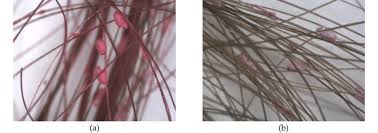 Blocks and lice knits the technical knowledge required in the early days to develop patterns that could be knitted on. Nits Stained With Neon Nits Lice Egg Locator Spray A Nits Coated Download Scientific Diagram