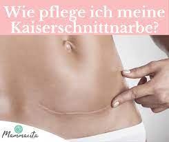 Wann wieder baden nach kaiserschnitt? Wie Pflege Ich Meine Kaiserschnittnarbe Mammacita