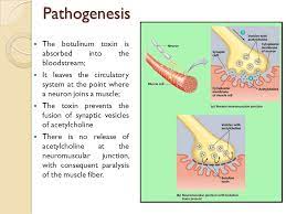 The durability of the spores makes it difficult to kill off the pathogen before it enters the host. Botulism Presentation Gabriela Pontes De Sousa Botulism Latin Botulus Sausage Is A Rare But Serious Paralytic Illness Caused By Botulinum Toxin Which Ppt Download