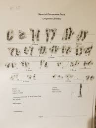 Student exploration human karyotyping gizmo … Solved Here Is The Karyotype For The Question Ignore The Chegg Com