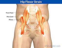 In other words, the hip flexor muscles are fundamental to everyday movement. Hip Flexor Strain Types Causes Symptoms Treatment Exercise Recovery