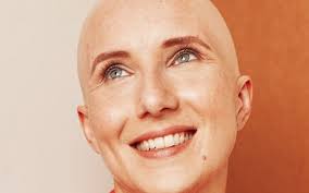 Penso che sia tutto soggettivo, ho infatti compagne di percorso terapeutico la . La Caduta Dei Capelli Durante La Chemioterapia Oncovia