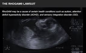 Image result for RhoGAM