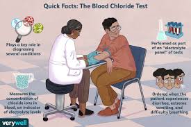 Blood Chloride Test Uses Side Effects Procedure Results