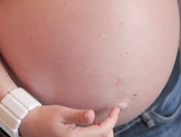 Die gängigen schwangerschaftstests, die sie in apotheke oder drogeriemarkt kaufen können, untersuchen eine urinprobe auf das schwangerschaftshormon hcg hin. Das Gefuhl Wenn Man Das Baby Das Erste Mal Spurt
