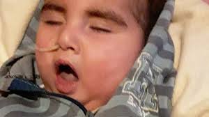 Petición · La cura al sindrome de menkes