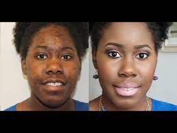A makeup primer is key to achieving a smooth and airbrushed appearance, even for girls with a mustache. How To Cover Dark Spots And Hyperpigmentation With Omolewa Makeup Youtube