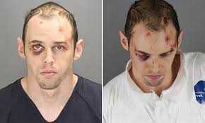 Michigan man suspected of strangling his father to death is seen bloodied  and bruised in mugshot