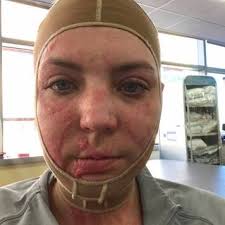 Toxic Command: US Army Ignores Nurse's Yearlong Pleas for Help; 1LT  Survives Attempted Murder by Deranged Civilian