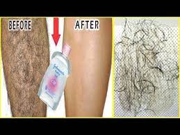 In 5 Minutes Remove Unwanted Hair Permanently With Baby Oil Amazing Baby Oil Beauty Hacks Youtube Unwanted Hair Removal Baby Oil Hair Unwanted Hair