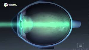 West alabama orthopaedic and sports medicine. 19 Eyecare Associates Locations Ideas Eye Care Eye Doctor Lasik