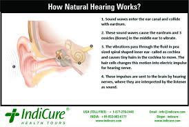Pin On Cochlear Implant Surgery