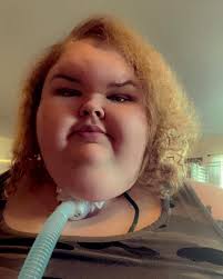 1000-Lb. Sister's Tammy Slaton's Body Transformation