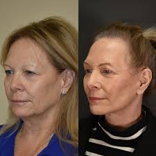 Daniel Straka, MD added a new photo —...