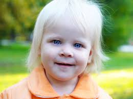 Omim #176270) is a complex neurogenetic disorder that affects 1 in 15,000 children, with 400,000 cases diagnosed globally (1). Prader Willi Syndrome Medlineplus Genetics
