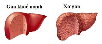 Káº¿t quáº£ hÃ¬nh áº£nh cho hÃ¬nh thá» ngoÃ i cá»§a gan