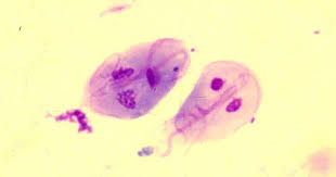 Pin On Parasites Of All Kinds