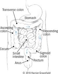 diverticular disease of the colon harvard health