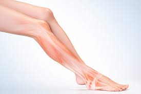 Image result for Compartment Syndrome