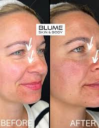 Medical Spa in Scottsdale & Paradise Valley