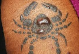 Here's everything you need to know before you make your appointment. Tattoo Blisters Causes Treatment Authoritytattoo