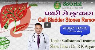 Your liver can make enough bile on its own. Gall Bladder Stone Treatment Without Surgery With Special Diet Dr R K Aggarwal Homeopathy360