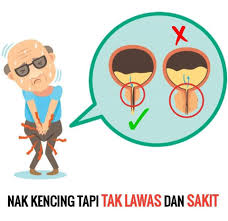 Kencing tidak lawas menyebabkan masalah sementara semasa membuang air kecil dan mudah untuk dirawat. Bv Medispa Kencing Tak Lawas Risiko Masalah Prostat Facebook