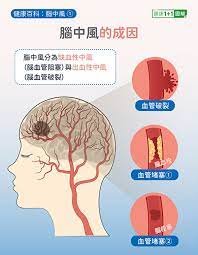 (this etymology is missing or incomplete. è„'ä¸­é£Ž4å¤§å‰å…†åˆ«å¿½ç•¥ ä¸­é£Žç—‡çŠ¶ æ²»ç–—å'Œå¤å¥å…¨å›¾è§£ ç¼ºè¡€æ€§ä¸­é£Ž è„'ä¸­é£Žæ²»ç–— è„'ä¸­é£Žç—‡çŠ¶ å¤§çºªå…ƒ