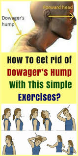 How To Get Rid Of Dowagers Hump With This Simple Exercises Easy Workouts Exercise Posture Exercises