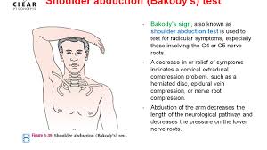 Image result for Spurling Sign