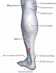 Pin On Health