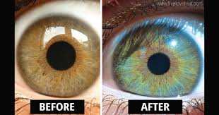 This Is How My Eyes Changed Colour After Eating Raw Vegan For 6 Years Eye Color Change Change Your Eye Color Raw Food Diet