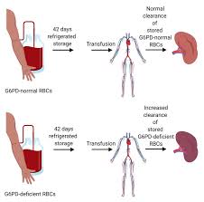 Image result for G6PD Deficiency Detection