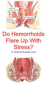 How Do You Get Hemorrhoids Cure For Hemorrhoids Hemorrhoids Treatment Hemorrhoid Remedies