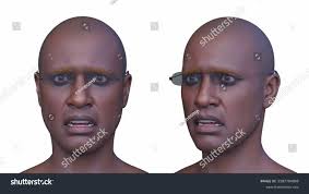 38 Face Mol Royalty-Free Images, Stock Photos & Pictures