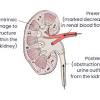 Our renal health care professionals strive to improve the lives of people with, or at risk for, end stage renal disease by promoting and advancing quality care. 1
