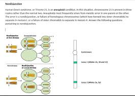 Solved Human Down Syndrome Or Trisomy 21 Is An Aneuploi Chegg Com