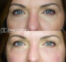 Pam Chaney Aesthetics (alicol0658)