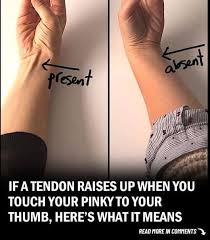If a Tendon Raises Up When You Touch Your Pinky to Your Thumb, Here's What  It Could Mean 🤩Full Article Comment👇💬