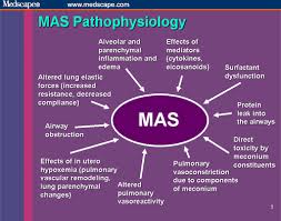 Respiratory Disease In The Neonate What Are The Best Approaches