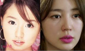 Country music star keith urban has been hitting the charts hard for quite some time … What Is The Juice Behind Korean Star Yoon Eun Hye Plastic Surgery Plastytalk