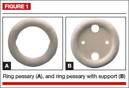 Pessaries For Vaginal Prolapse Critical Factors To