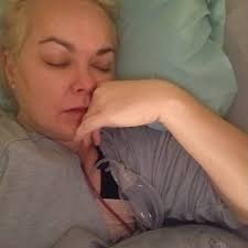 Has anyone had their motiva implants removed after symptoms appeared?