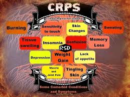 Pin On Rsd Crps